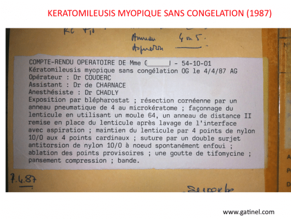 Compte rendu d'une intervention de Keratomileusis myopique sans congélation
