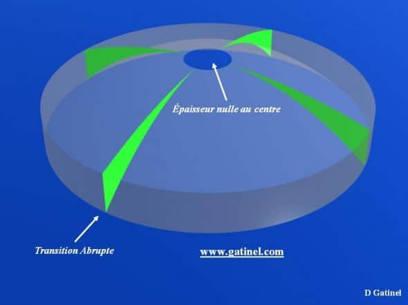 correction hypermétropie profil ablation