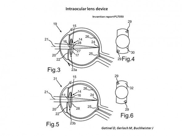 Implant reversible Gatinel et al.
