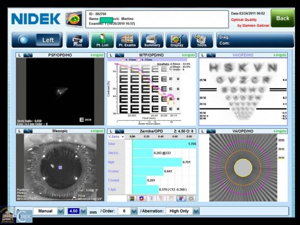 qualité optique implant décentré MTF