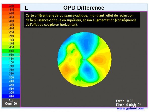 carte différentielle OPD vergence