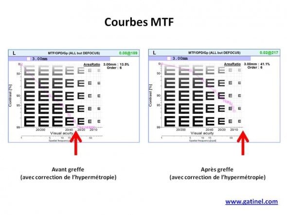 carte MTF