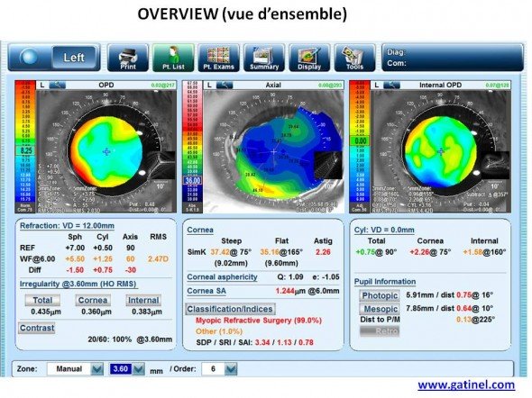 carte OPD post incisions relaxantes