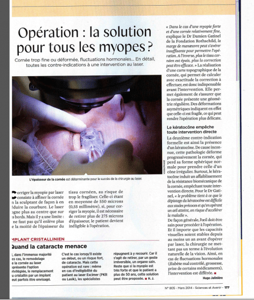 Sciences et Avenir - Myopie chirurgie
