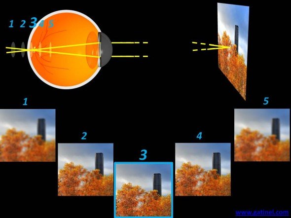 oeil non myope plan de l'image