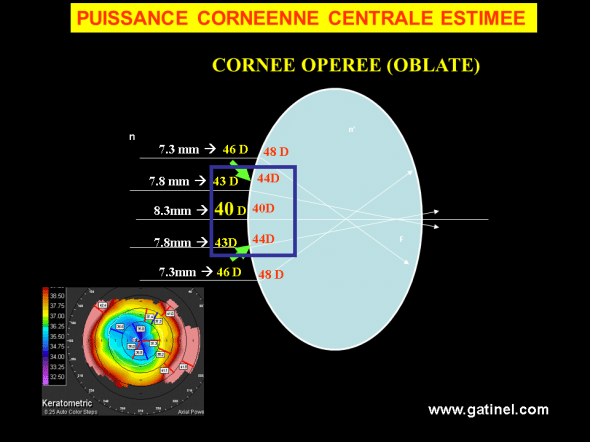 kératométrie cornée oblate