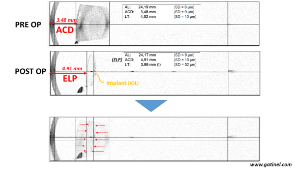 biométrie ELP