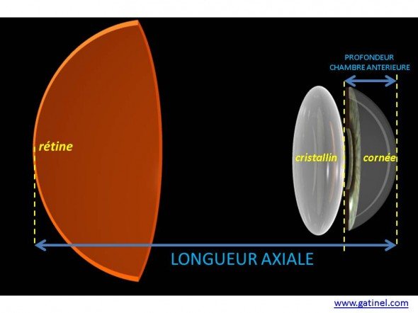 biométrie oculaire, longueur axiale kératométrie