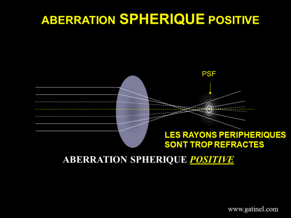 représentation schématique de l'aberration sphérique positive;
