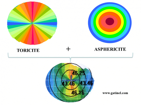 effet conjugués de la toricité et de l'asphéricité