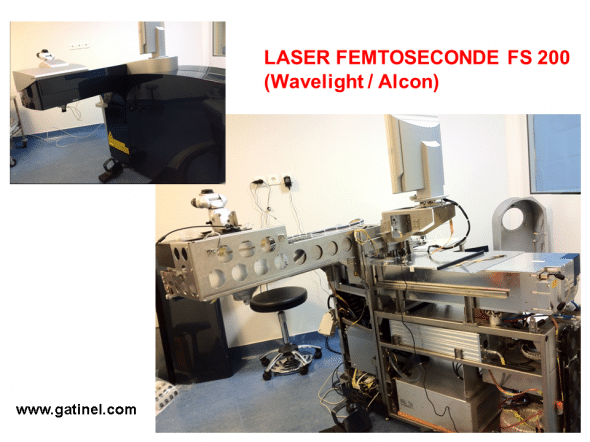 Laser femtoseconde Alcon/Wavelight FS150 avant et après retrait des coques d’habillage. La cavité laser est située à la partie supérieure de la partie principale. 
