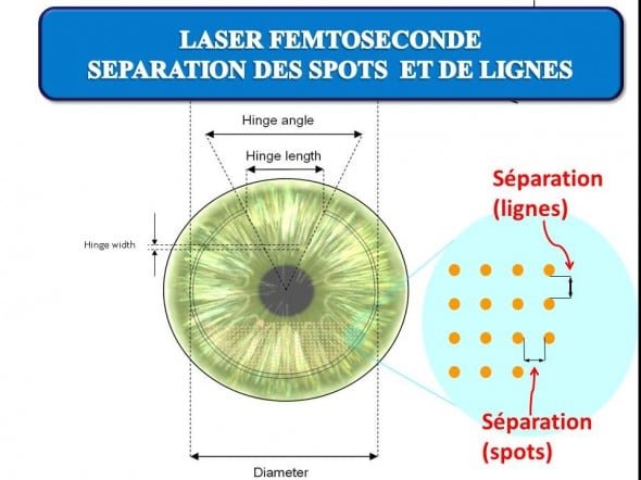 L'écartement des spots délivrés au sein de la cornée est régulier: l'espacement entre les spots et les lignes est de l'ordre de 8 microns.