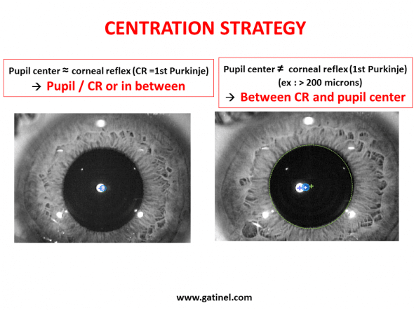 Depending on the deviation between the pupillary axis and visual axis (angle Kappa), the location of the visual axis intercept at the corneal plane may vary.