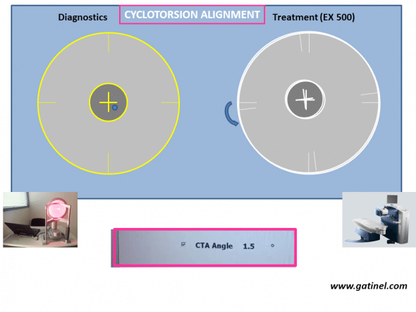 Cyclotorsion angle
