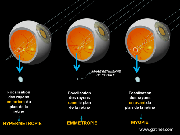 tache de défocalisation
