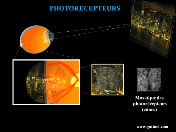 Cones et image rétinienne