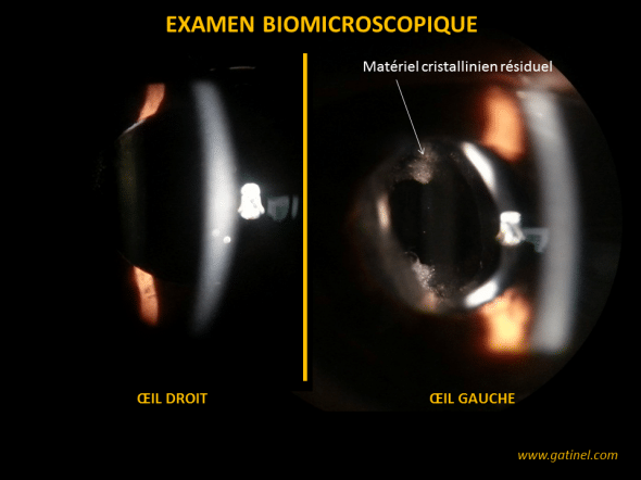 apsects biomicroscopique