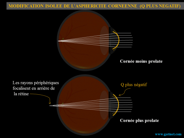 Asphéricité prolate