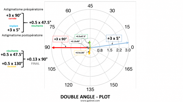 Calcul des effets cumulés de l'incision et de l'implant torique vis à vis de l'astigmatisme initial (cornéen).