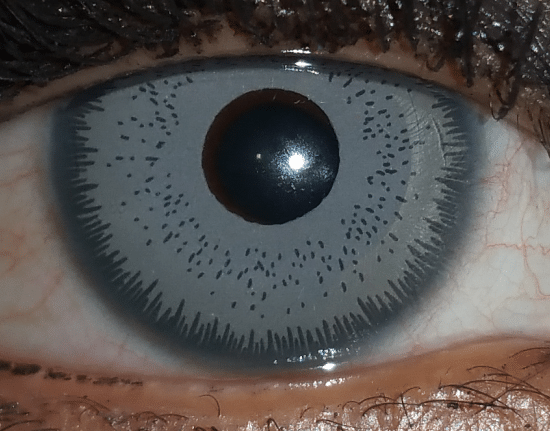 iris blue bright ocular