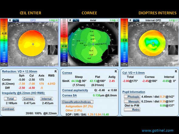 opdscan III