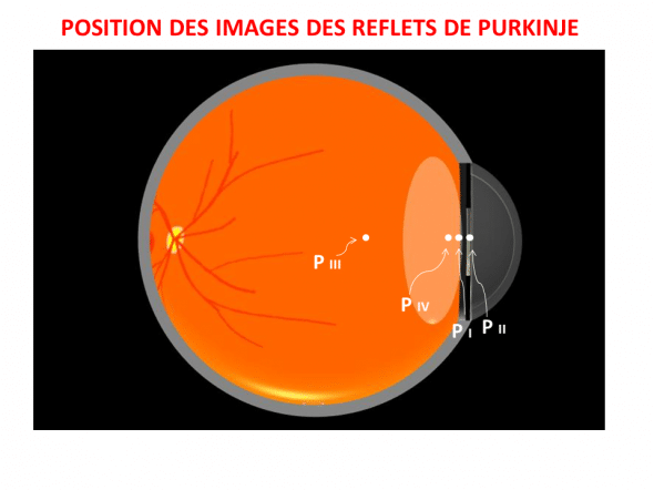 images Purkinje position