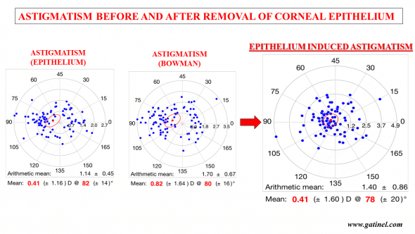 Double plot astigmatism charts of the included eyes. Left: corneal (epithelium on) astigmatism. Middle, astigmatism measured at the Bowman’s layer. Right: epithelial induced astigmatism. 