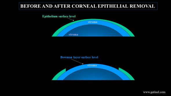 epithelium layer relation to Bowman layer