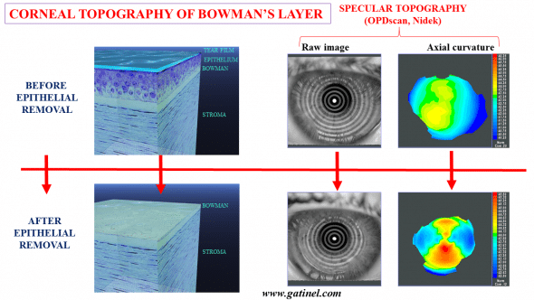 Bowman layer topography