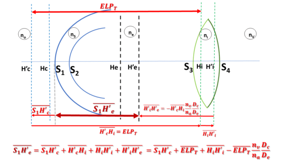 Axial lens segmentation<