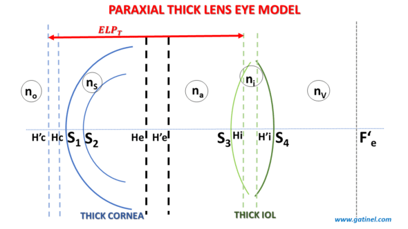 The position of the focal point of the optical system corresponding to the cornea + IOL (F’e) with respect to the plane of the photoreceptors of the eye determines the refraction of the pseudophakic eye. If the focal point F'e is located in this plane, the pseudophakic eye is emmetropic. If it is located in front, the eye is myopic, and if it is located behind, the eye is hyperopic.