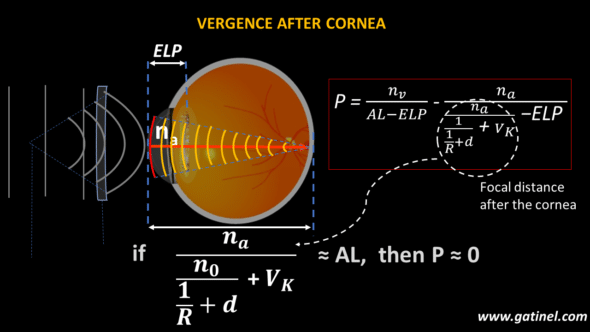 Focal distance after the cornea equal to axial length