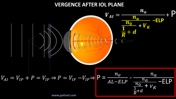 IOL power formula vergence computation thin lens cataract surgery intraocular lens power