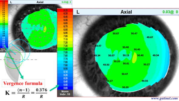 this topographic map called axial curvature was obtained using the vergence formula from local curvature data (in mm) and a refractive index equal to 1.376 (refractive index of the stroma) so that it can be compared with the refractive power map (calculated with the same refractive index value for the corneal stroma axial curvature cornéel topography from millimeter to diopter
