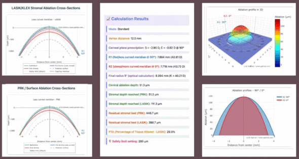 Bilateral OD/OS Corneal Ablation Simulator — PRK, LASIK and KLEX/SMILE planning