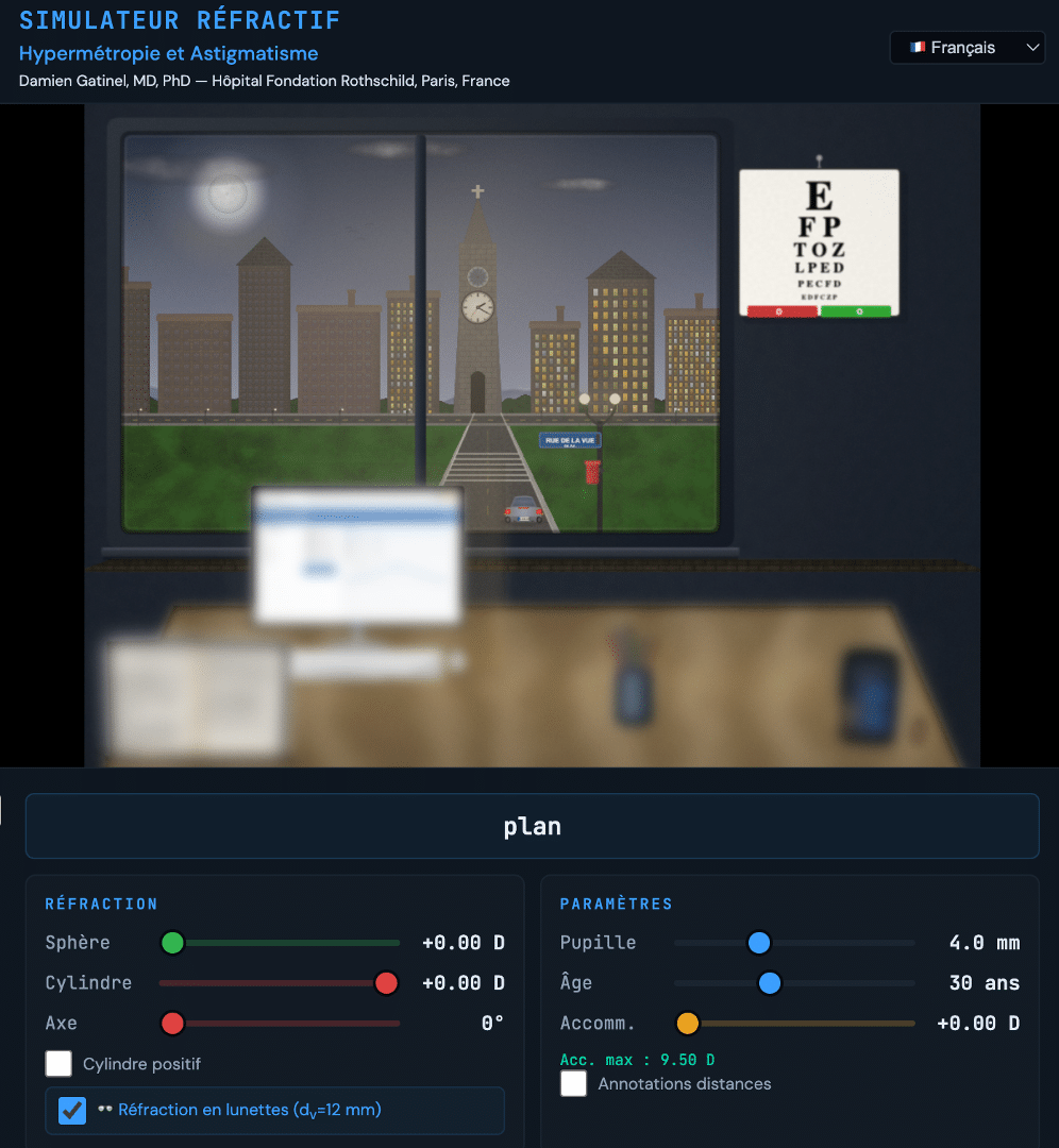 Simulateur de vision hypermétrope et astigmate — Simulation du flou visuel et de l'effort accommodatif